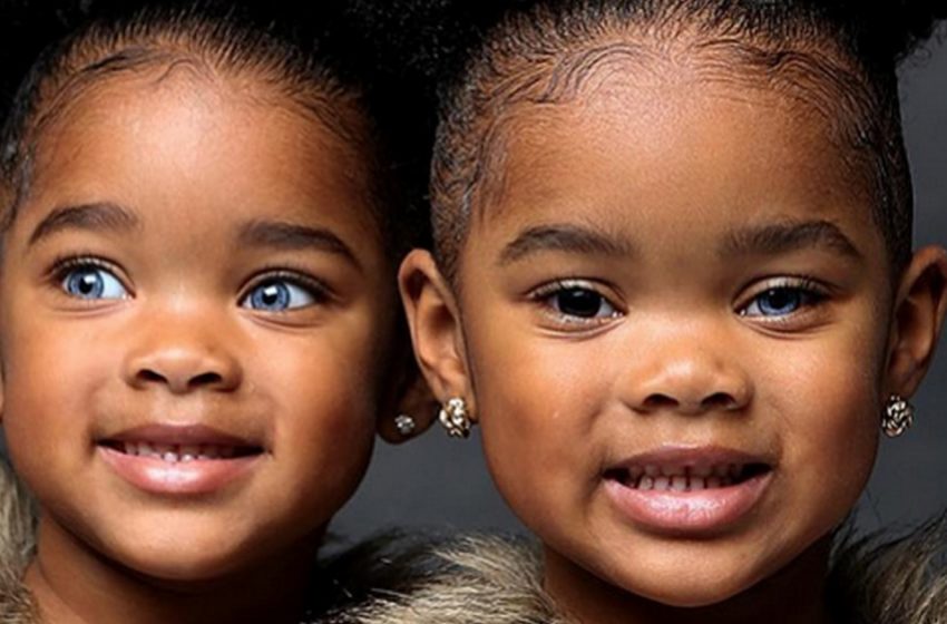  Twins with unusual eyes are already 8 years old. And they are amazingly beautiful!