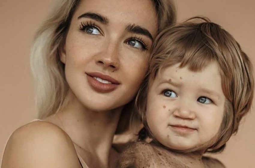  Popular Instagram blogger amazed the social media by sharing the photos of her son. The boy has inborn “skin peculiarity”…