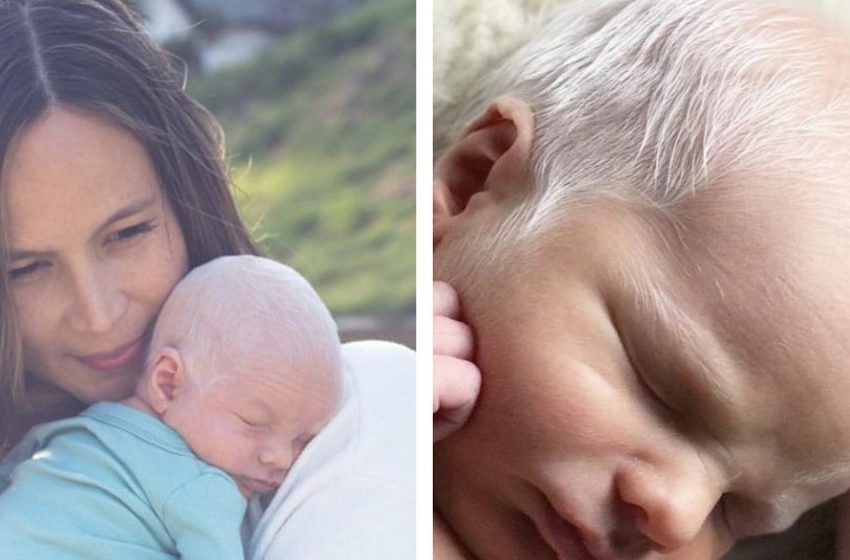  Boy Born With White Hair Becomes A Model A Few Years Later