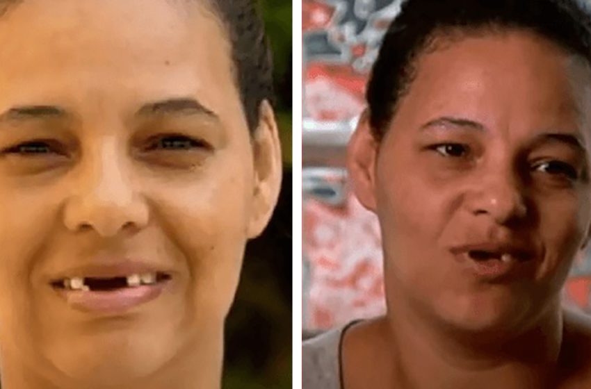  Woman Restores Her Beauty Thanks To The Beauty Program