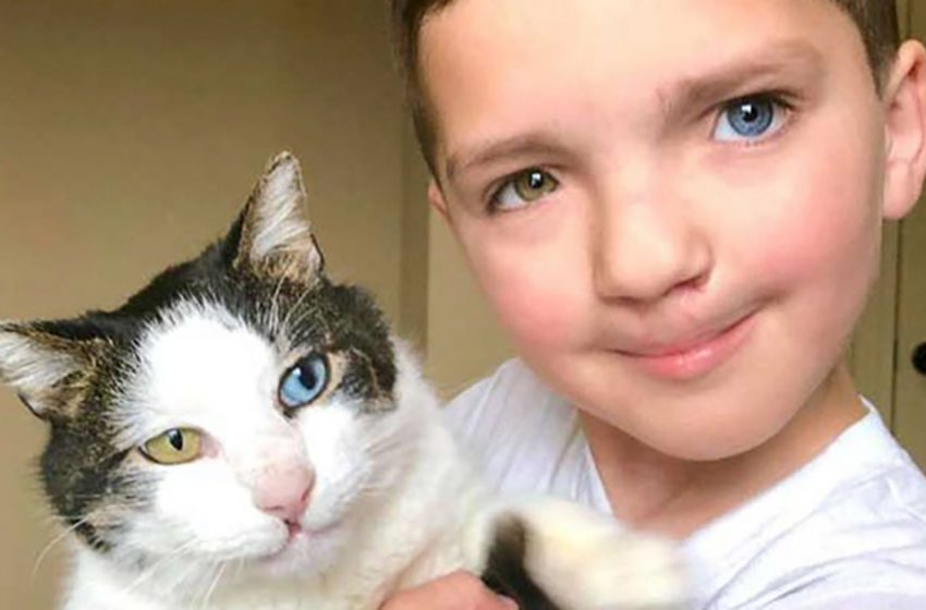  Boy With A Rare Condition Finds A Cat Thats Looks Exactly Like Him