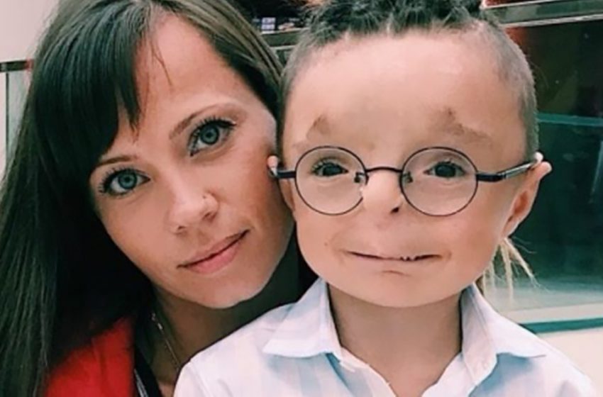  Kind Woman Adopts A Baby Boy That Everyone Bullied
