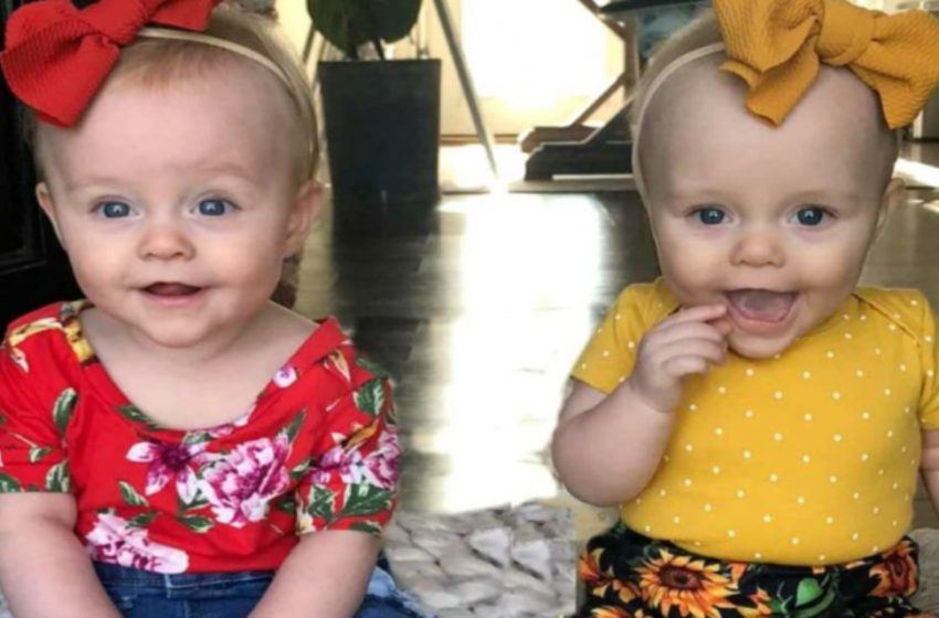  One Of The Twins Saved Her Sister’s Life While Still In The Womb