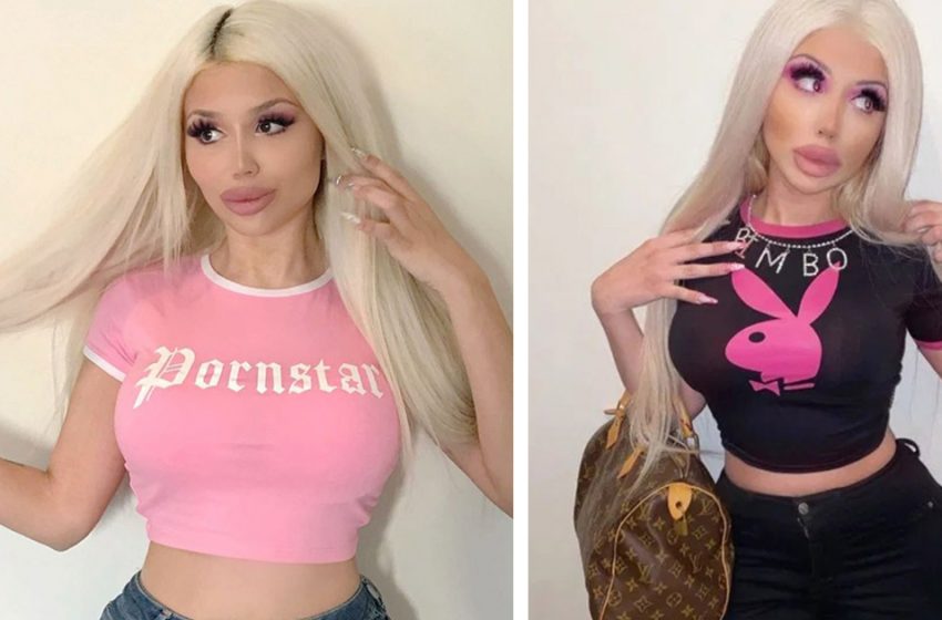  “She Began To Do Plastic Surgeries At The Age Of 13!” See How She Looks Now