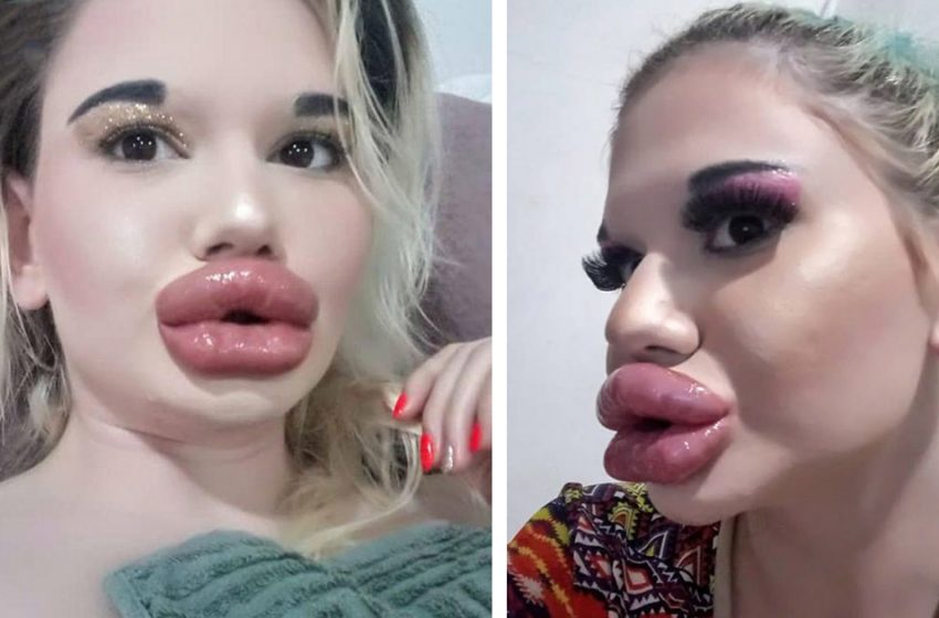  “Surgeons Disfigured The Beauty”: Look What a 22-Year-Old Girl Looked Like Before The Plastic Surgeries!
