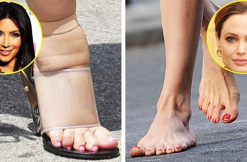  “Twisted And Imperfect”: Non-Star Celebrity Feet That Are Discussed On The Net!