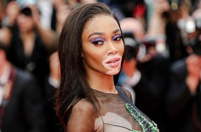  “Chocolate Supermodel In a Dress That Covered Nothing”: Winnie Harlow Came To Her Friend’s Wedding In a Provocative Outfit!