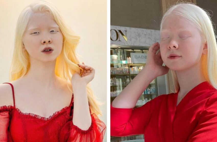  “Snow White Beauty”: The Albino Sisters Amaze With Their Rare Beauty!