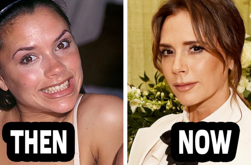  “It’s Amazing How Age Befits Them!” Stars Who Are Better Now Than They Were 20
