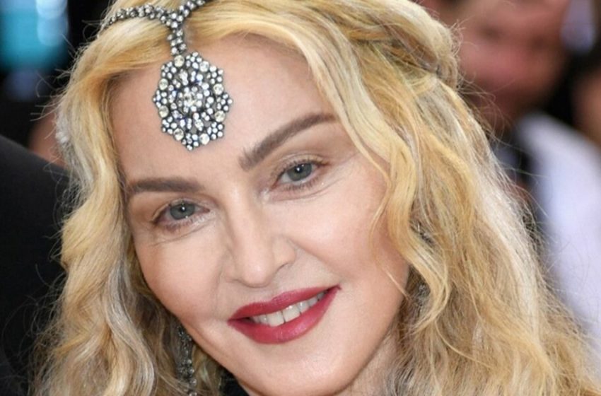  I lost half of my face and cheeks! Fans no longer recognize the singer Madonna