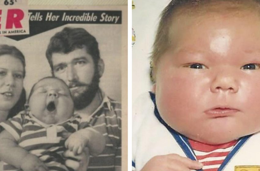  In 1983, a baby boy weighing more than 16 lbs was born. How does he live 39 years later