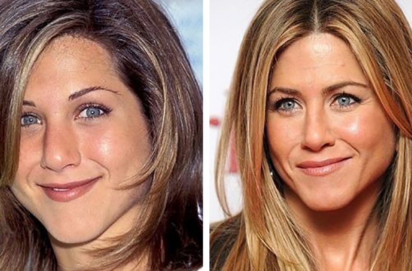  “Rhinoplasty – Yes Or No?”: 10 Celebrities Who Have Become Much More Attractive After Their Nose Changes!