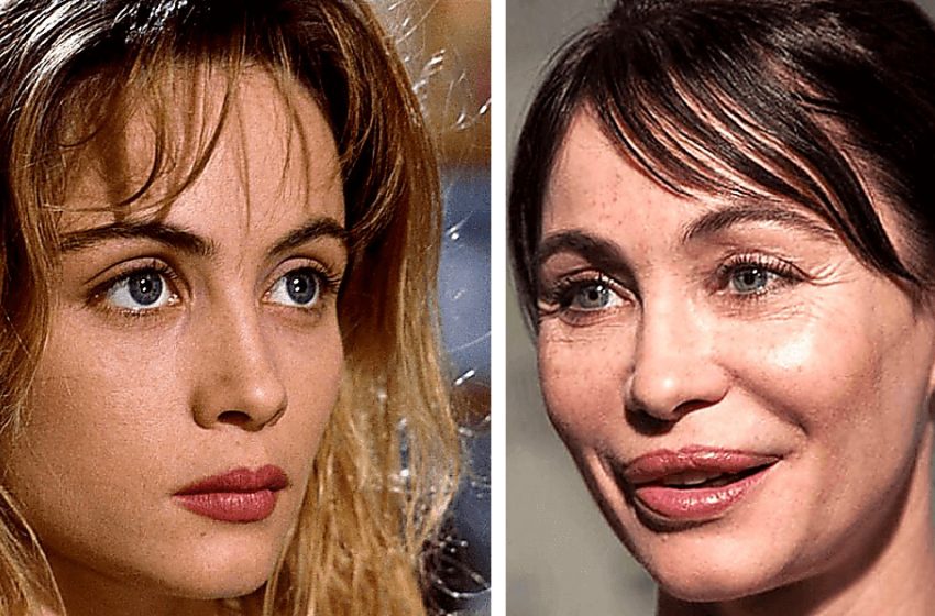  “Helped Some, Ruined Some!” The Most Famous Transformations Of All Time