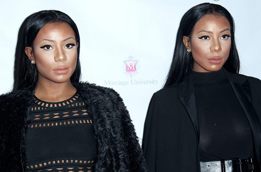  Victims of Plastic Surgery: What America’s Most Famous Twins Look Like Now