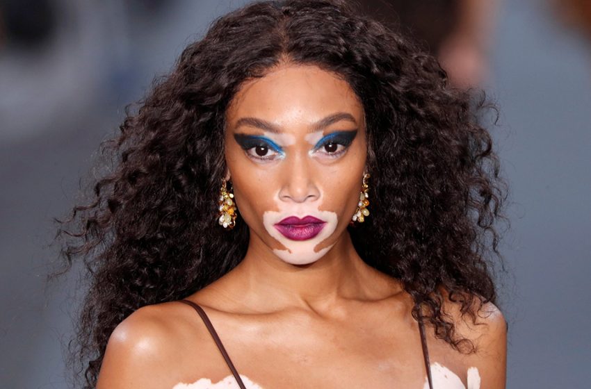  “Seems To Be Wearing Half Of The Dress!”: Winnie Harlow’s ‘Invisibility Dress’ Is Making a Splash Online!