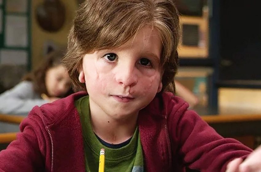  “It Is Impossible To Recognize Him Without Makeup”: What Does The Actor Who Played The Boy Oggy In The Film “Miracle” Look Like Today?