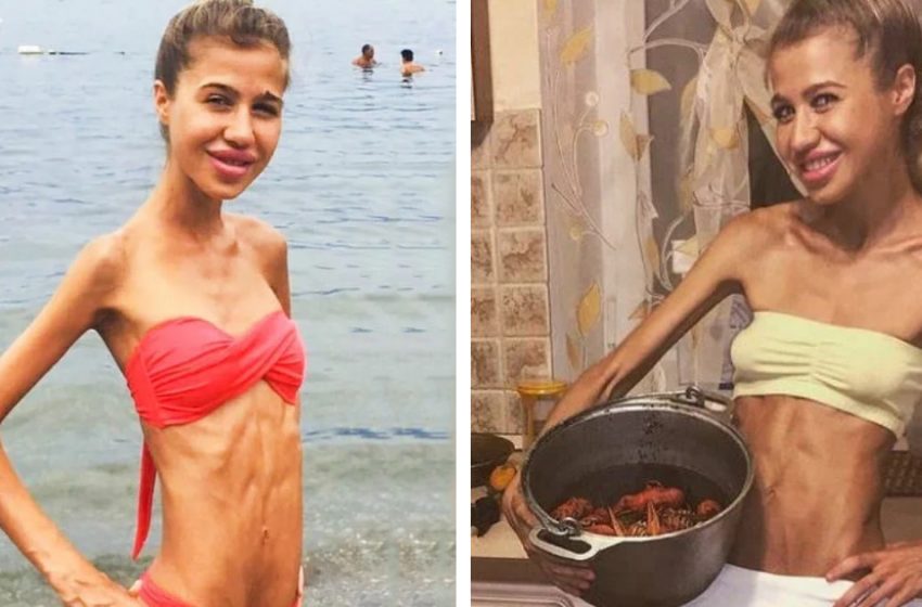  “Such a Strong Girl”: What Does a Reality Show Participant Who Weighed Only 40 lbs Look Like Today?