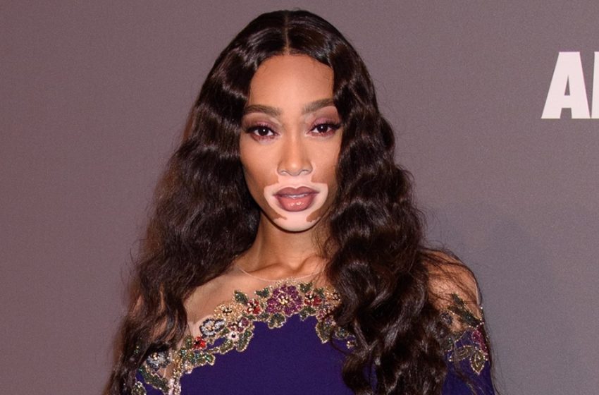  “Her Clothes Did Not Cover Anything”: Winnie Harlow Went Out For a Night Walk In Invisible Pants!